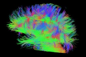 Colorful image of blue, red, green and orange showing the impact of video game play on neurocognitive functioning.