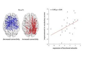 First image of the brain with blue highlights depicts decreased connectivity. Second image of brain with red highlights depict increased connectivity. 3rd image of graph depicting improvement in vocabulary scores.